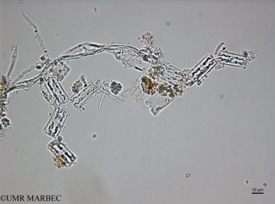phyto/Thau_Lagoon/THAU_station1/OSU_plancton 2017/Grammatophora marina (100117_grammatophora180518_001_ovl-1).tif(copy)_thumb.jpg